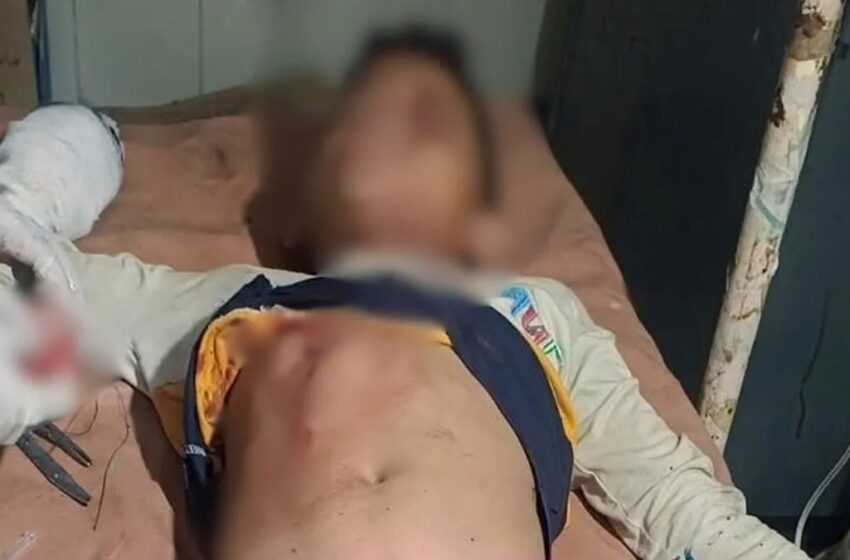  उत्तराखंड: बारूद से भरी बोतल फटने से तीन किशोर झुलसे, एक की हालत गंभीर